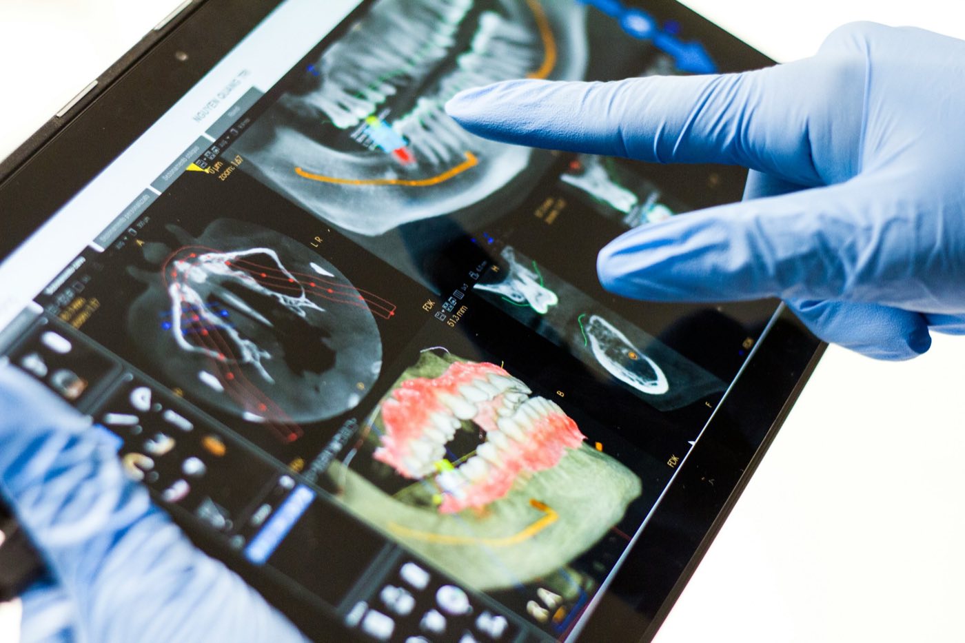 Nico reviewing CBCT planning data on a tablet